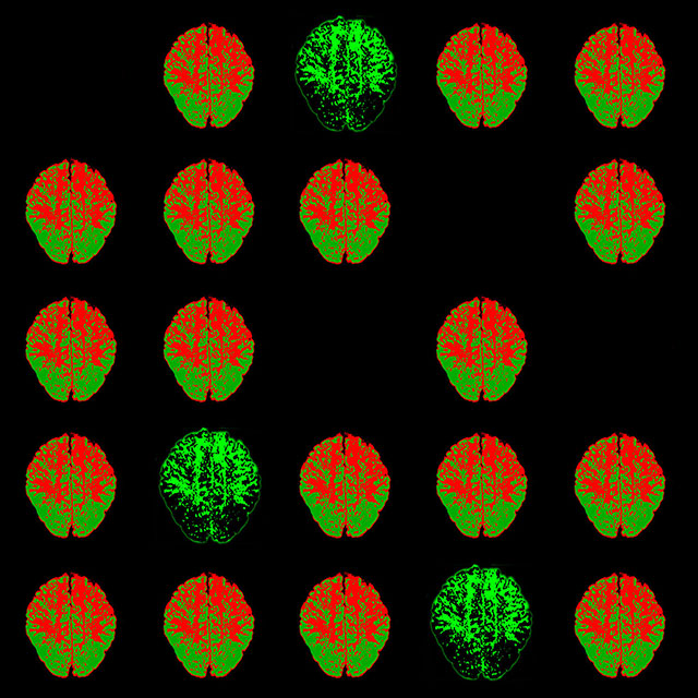 fabrizio borelli roma foto a colori con sfondo nero e immagini di radiografie del cervello colorate di arancione e verde