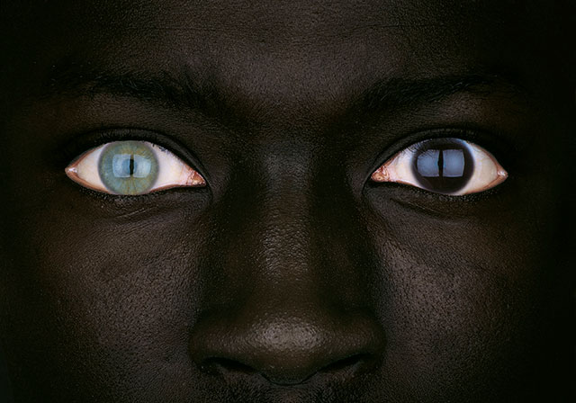 oliviero toscani foto a colori di primio piano degli occhi di due diversi colori ,uno azzurro e uno marrone,di ragazzo africano