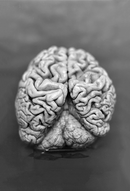 Christian Fogarolli Trento foto in bianco e nero di cervello umano
